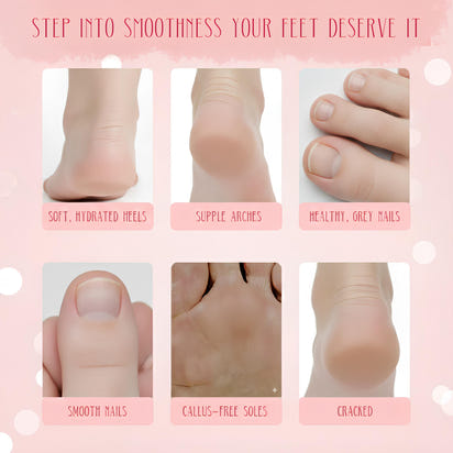 Electric Foot Grinder – Automatic Callus Remover & Pedicure Tool for Smooth, Soft Feet