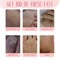 Electric Foot Grinder – Automatic Callus Remover & Pedicure Tool for Smooth, Soft Feet