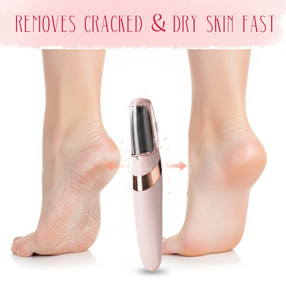 Electric Foot Grinder – Automatic Callus Remover & Pedicure Tool for Smooth, Soft Feet